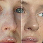 Nose Patches - Cerotti Nasali